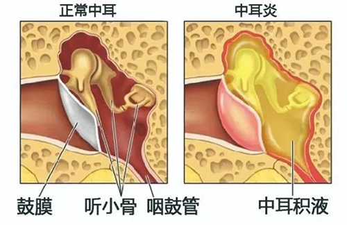 一年一度愛耳日，今年關(guān)愛不一般