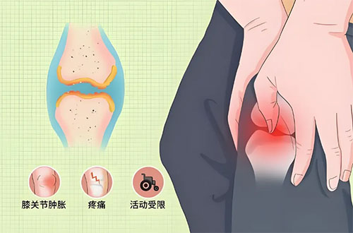 膝關(guān)節(jié)假體置換術(shù)：重啟生命律動，邁向美好未來