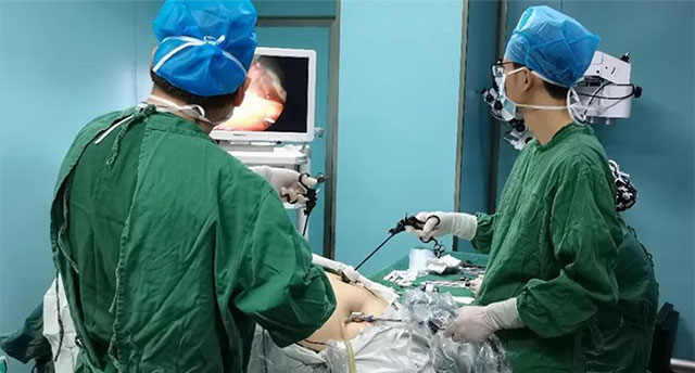 合肥中山醫(yī)院外科 腹腔鏡下袖狀胃切除術(shù)